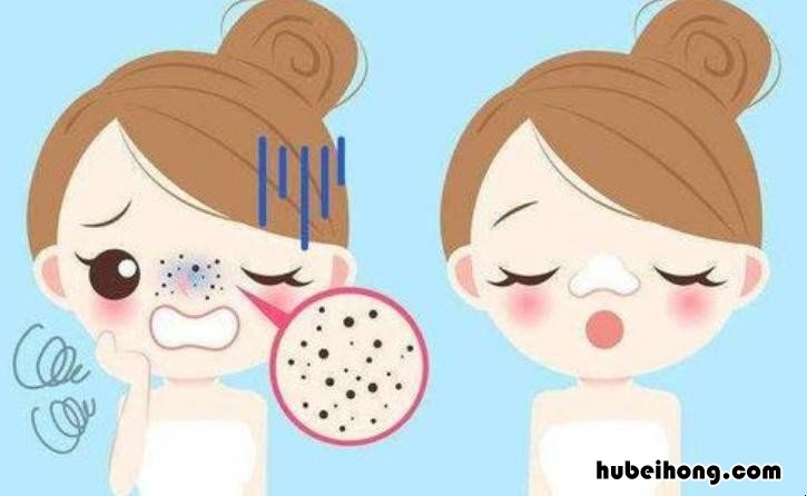 用什么可以有效去黑头 用什么能有效去黑头