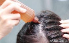 头发油怎么办小妙招不能洗头 头发油怎么办?去除头发油腻的秘诀