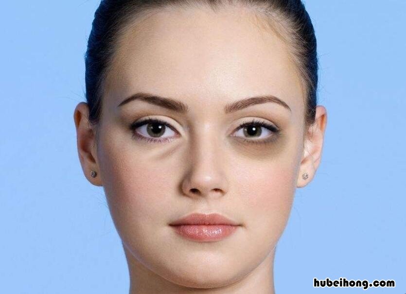祛眼袋最好方法是什么 什么方法祛眼袋效果最好