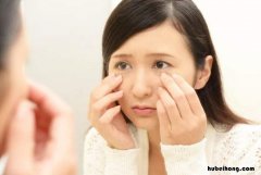 脸上有好多斑怎样祛斑最有效 脸上有好多斑怎样祛斑最好