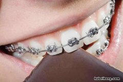 牙缝宽怎么补 牙缝大了怎么处理方法