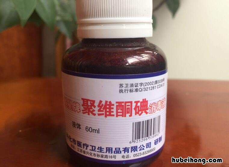 衣服染到碘伏 衣服染上碘伏怎么去除味道小妙招