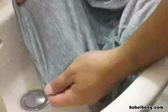 红药水怎么洗去血渍 红药水怎么洗去血迹