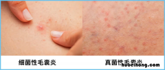 夏款衣服的面料 夏季衣服穿什么面料的好