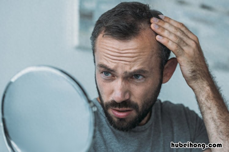 男人睡的枕头发黄是什么原因 男人的枕头特别容易发黄