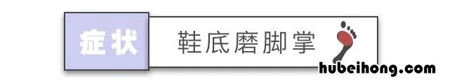 鞋子磨脚怎么办?教你如何轻松解决 鞋子磨脚该怎么办?