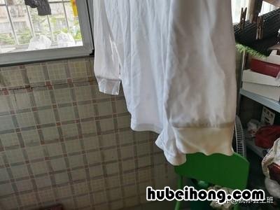 衣服有霉斑怎么清洗妙招 衣服有霉斑怎么处理