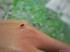 白糖加酵母能生根吗 长期吃酵母馒头的危害