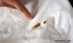 如何去除衣物上的血迹 怎样去掉衣物上的血迹小妙招