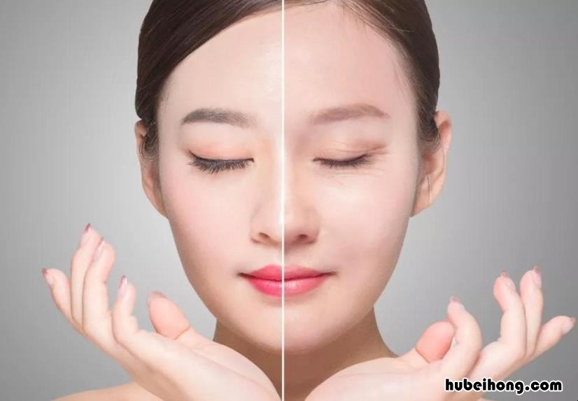 面部线雕术后注意事项有哪些 面部线雕术后注意事项有哪些禁忌食物
